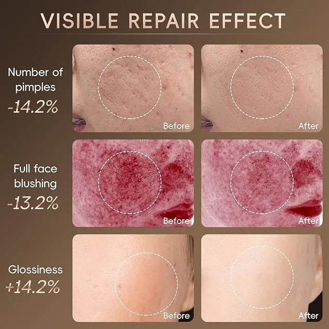 Light Therapy Face Mask (ZENDROP)